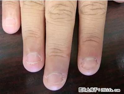 剪指甲、挖耳屎,这些日常小动作竟隐藏大危害! - 巢湖生活资讯 - 巢湖28生活网 ch.28life.com